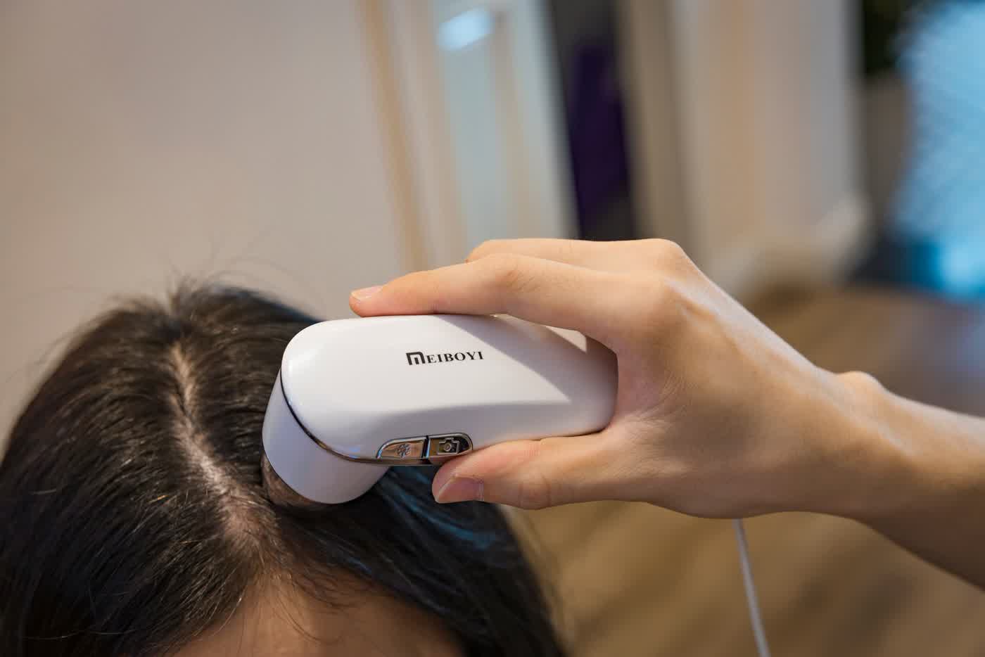 Scalp analysis
